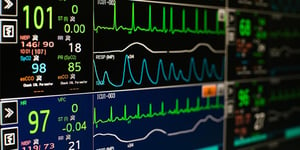 Industry 4.0: Cloud-Based Equipment Health Monitoring image